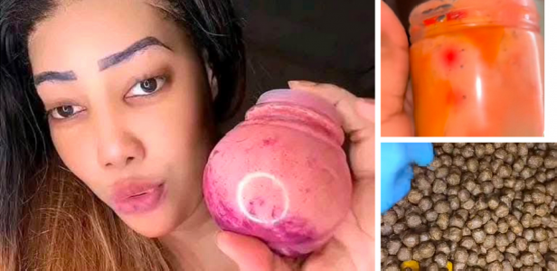 Produits fessiers : Comment Alima 