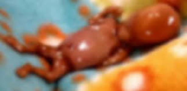 Ucad : un fœtus retrouvé dans un car Niaga Ndiaye 